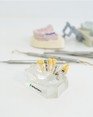 Instagram Implantes